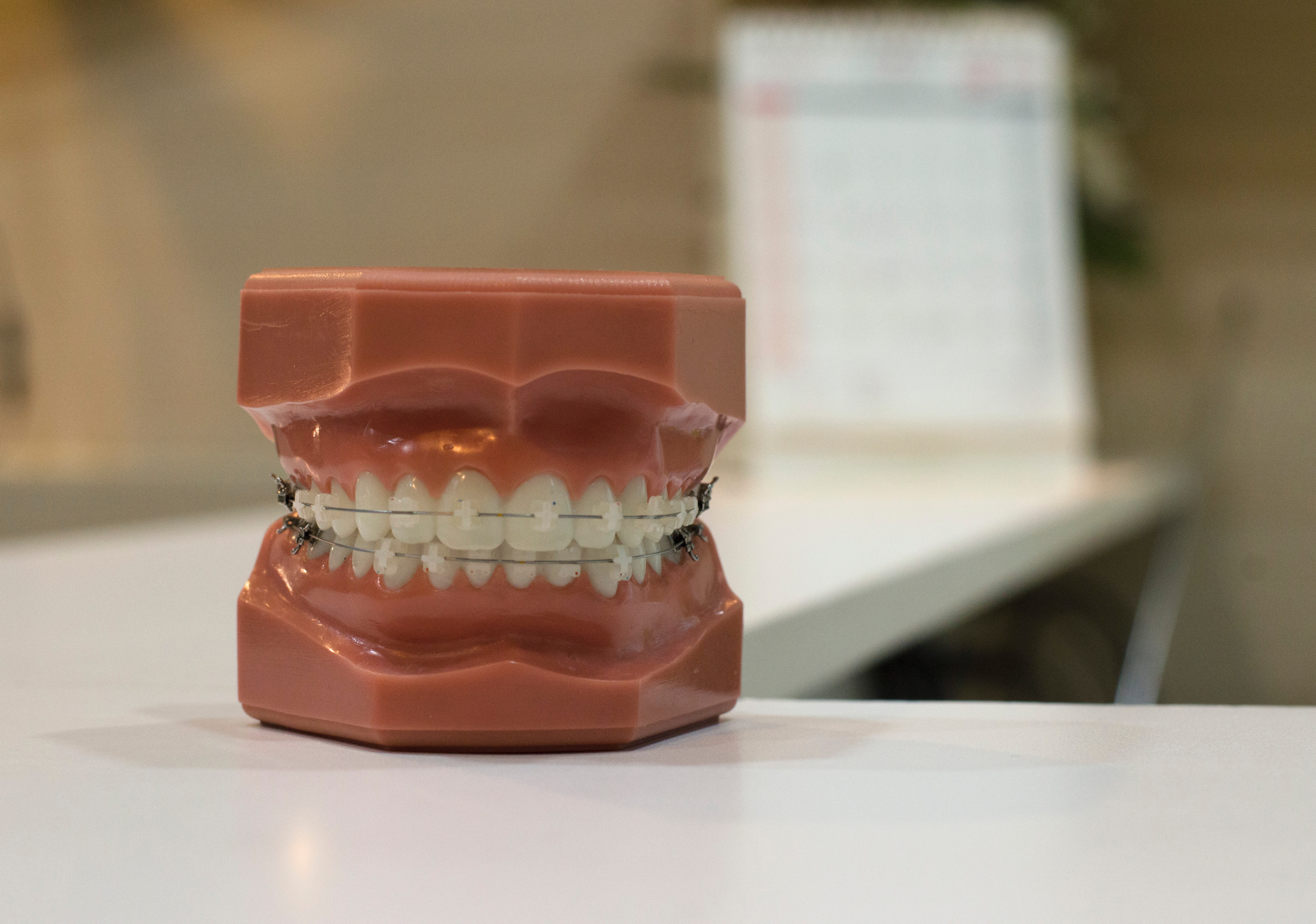 5 Reasons Anxious Patients Don’t Book a Dentist